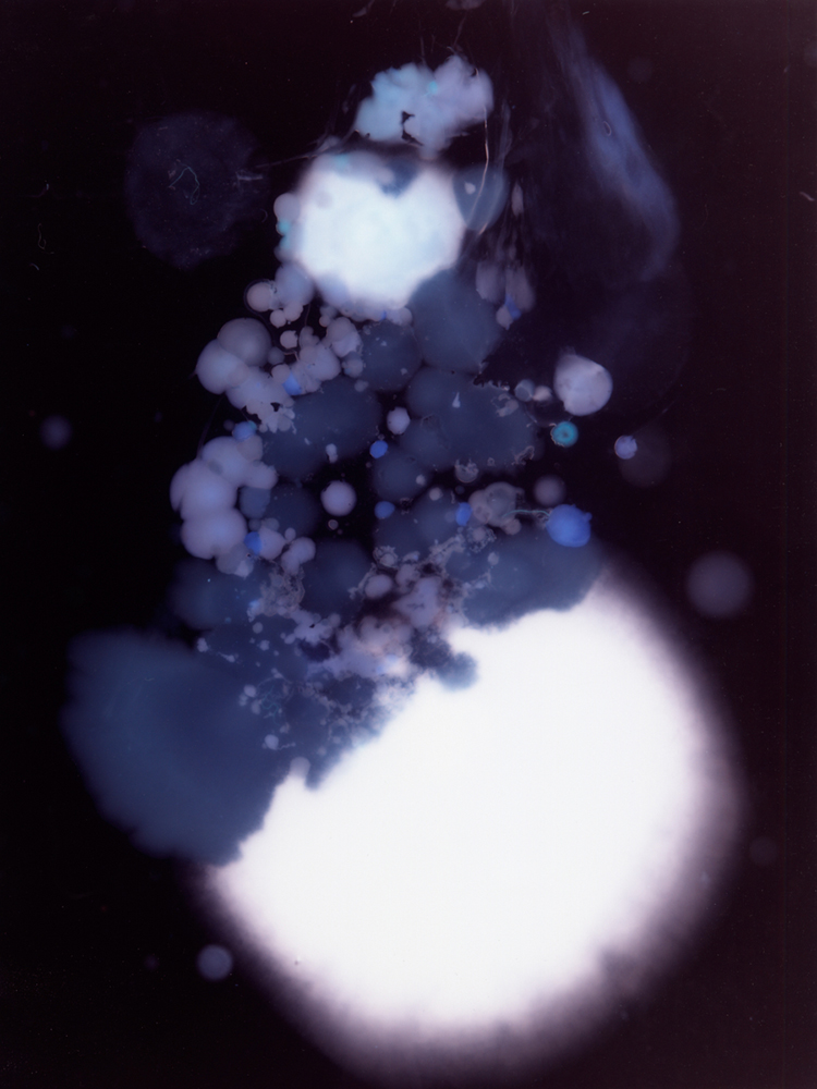 Les Ombres de nos constellations, bacteries,